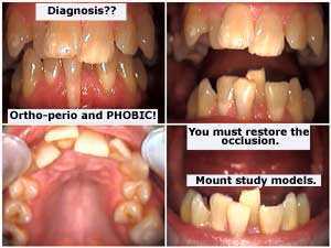 diagnosis, treatment plan, examination, dental interpretation, chief complaint, symptoms, occlusion