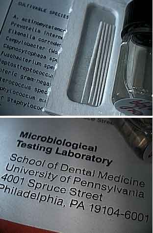 oral microbiology dental aerobic bacteria anaerobic heart disease gum infection diabetes spirochetes