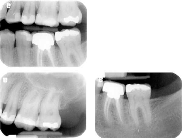 Emergency Diagnosis of TMJ pain, Differential Diagnosis of tooth pain or non-dental origin, TMD