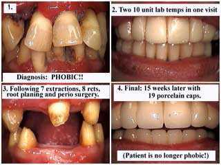 Dental Anxiety Dental fear of dentists sedation smile makeover dental phobia
