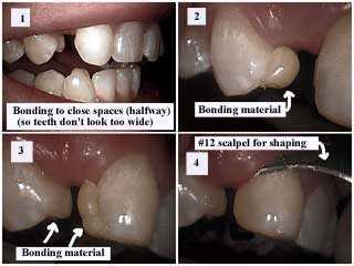 Lightning dentist does a lot more than just fill in the gaps