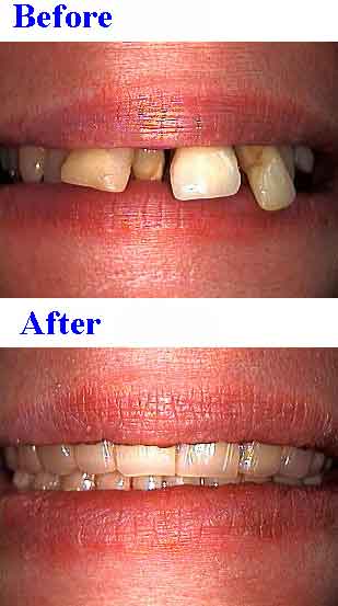 oral rehabilitation dental reconstruction smile makeover mouth teeth Dr Dorfman anxiety