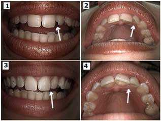 smiles, smiling, face facial proportion esthetics cosmetics aesthetics tooth tv actress smile