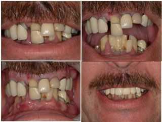 oral rehabilitation dental reconstruction smile makeover periodontal prosthesis Dr Dorfman interns