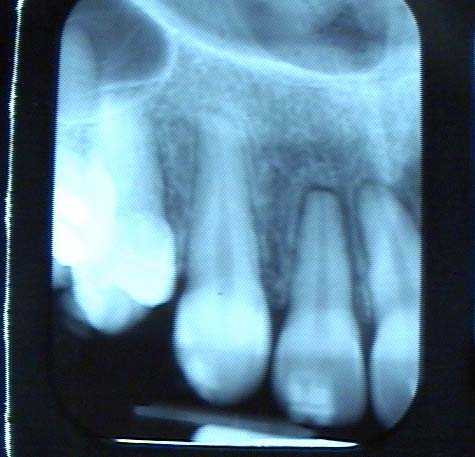 Orthodontic theory how teeth braces dental how to explain orthodontist tooth movement mobility