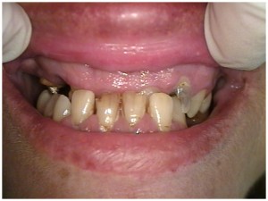 cosmetic dentistry smile makeover make over